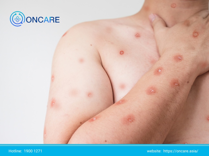 Nguyên nhân gây ra các bệnh về đường hô hấp do hậu quả của bệnh lý khác