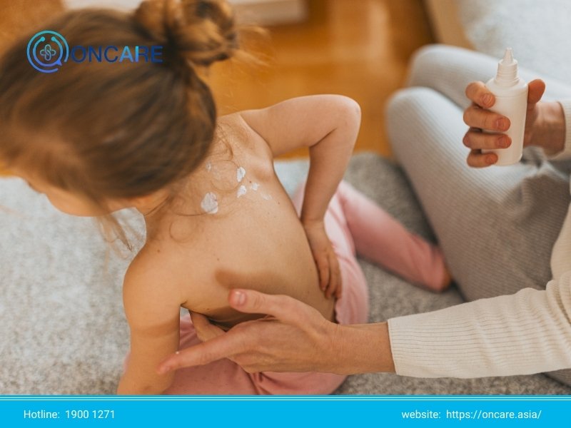 Bệnh đậu mùa: Nguyên nhân, phân loại, triệu chứng và cách phòng ngừa