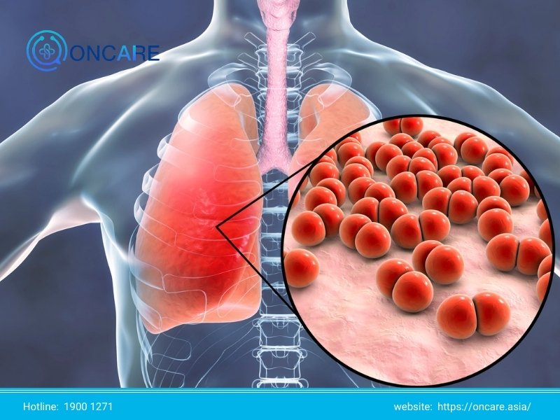 Các bệnh lây qua đường hô hấp thường gặp và cách phòng tránh
